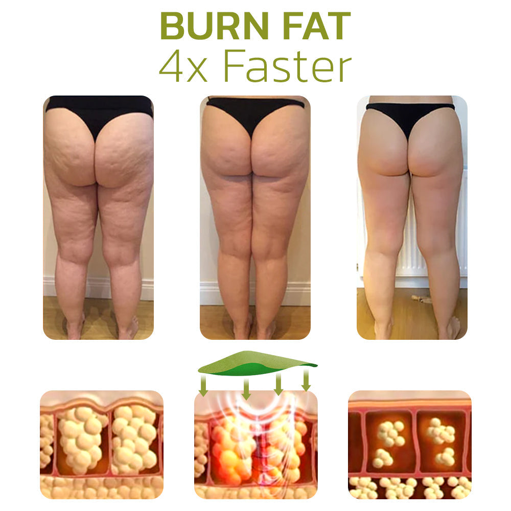 Advanced Cellulite Reduction Cream for Smoother Skin