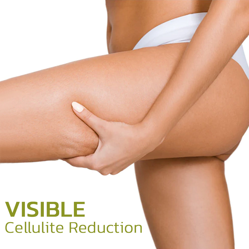 Advanced Cellulite Reduction Cream for Smoother Skin